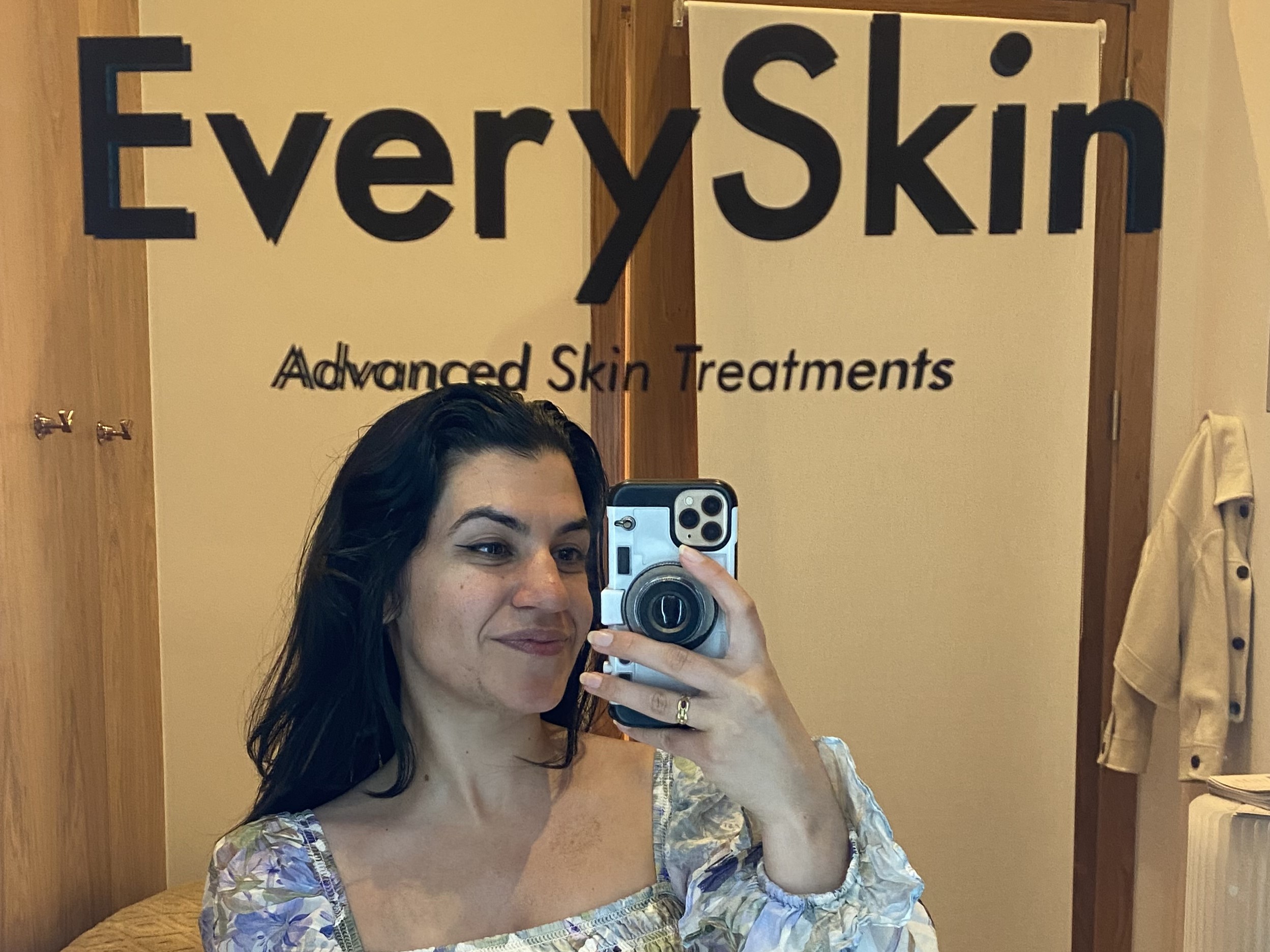 Vanessa before her EverySkin Facial | Space NK Vanessa before her EverySkin Facial | Space NK